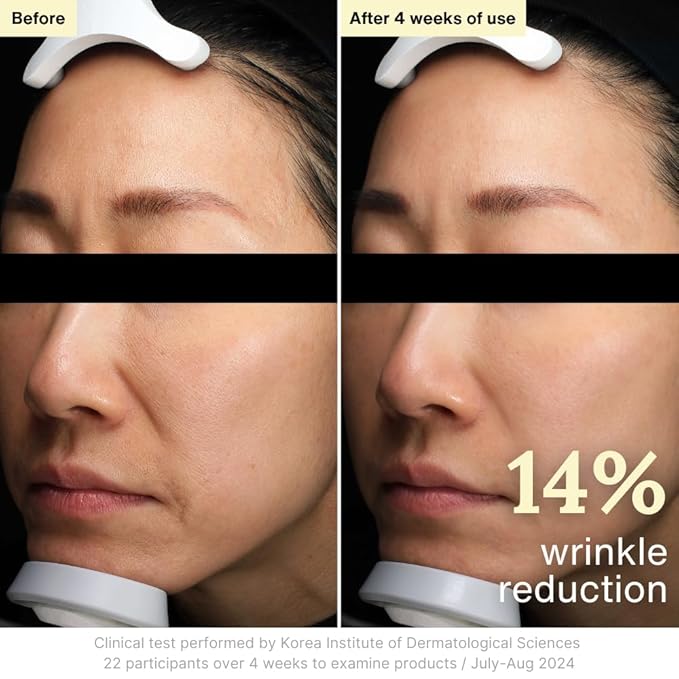 Rothea Resilience Cream, Anti-Aging with Bakuchiol 10,000ppm (Natural Retinol Alternative), Face Moisturizer, Neck Cream with Collagen, Ceramides, Peptides, Niacinamide, Korean Skin Care, 1.7 oz