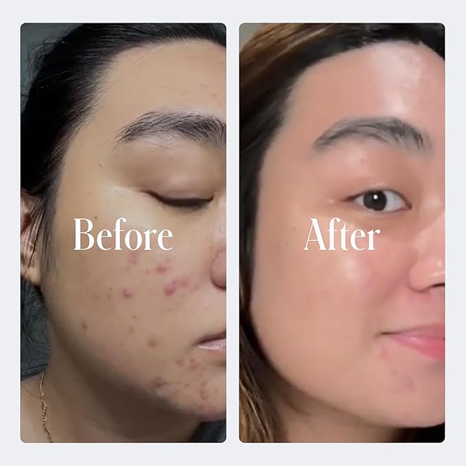 Geologie Retinol Anti-Aging Face Cream | Enhanced .2% Retinol Formula for Effective Results | Reduce Fine Lines & Wrinkles | Protect & Repair Skin With Hyaluronic Acid & Niacinamide | For Men & Women