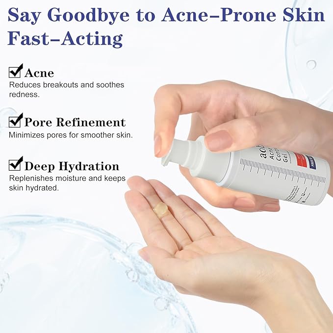 SINPIN aobenz Control Gel with 2% Salicylic Acid & Botanical Extracts | Acne Treatment for Face & Body, Gentle for All Skin, Natural & Fast Relief, 1.7FL